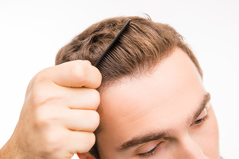 Why have an FUE Hair Transplant - Paras Hair Transplant